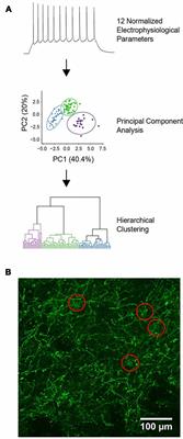 A Novel Type of Neuron Within the Dorsal Striatum